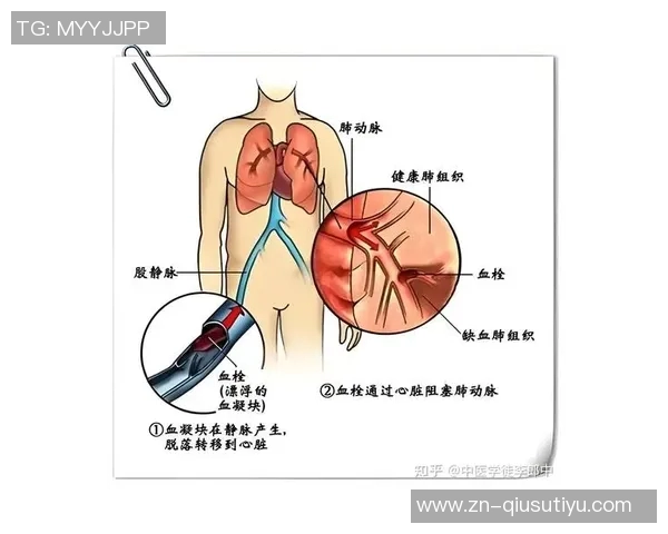 文班谈血栓伤病的医学分析与心理状态的积极应对 文班谈血栓伤病的医学分析与心理状态的积极应对